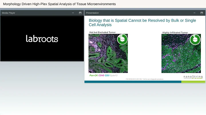 Morphology Driven High Plex Spatial Analysis of Ti...