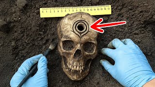 農家が見つけた300年前の未知の人類の頭蓋骨