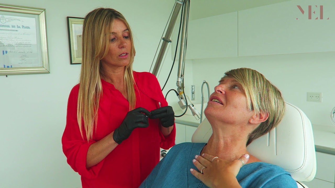 BOTOX EN CUELLO (Con toxina botulinica ) @drapedreira