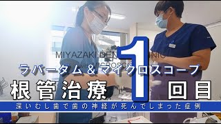 １回目　根管治療（３回シリーズの１回目）　歯の神経が死んでしまい腫れている症例　急患対応時の様子