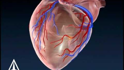 Coronary Plaque - 3D Medical Animation