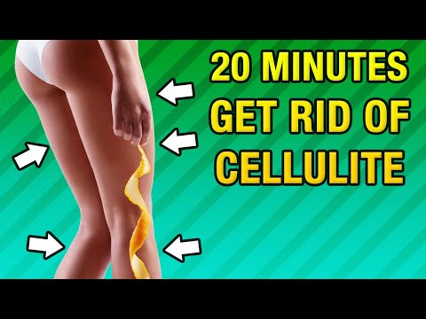 Video: Paano Mabilis Na Mapupuksa Ang Cellulite