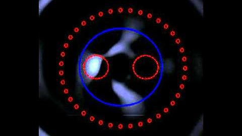Multizone soundfield reproduction with free-field settings