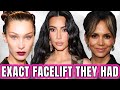 What Facelift Did Kim Kardashian, Bella Hadid, Madonna and Halle Berry Get? With Dr. Gary Linkov