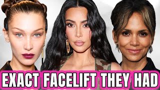 What Facelift Did Kim Kardashian, Bella Hadid, Madonna and Halle Berry Get? With Dr. Gary Linkov