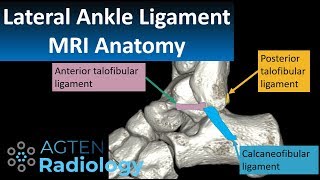 MRI Anatomy  of lateral ankle ligaments