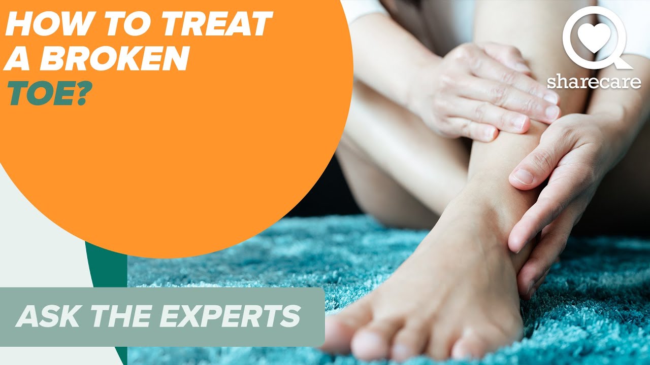 How To Treat A Broken Toe Ask The Experts Sharecare Youtube