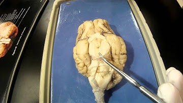 Sheep Brain Dissection (Part 1)