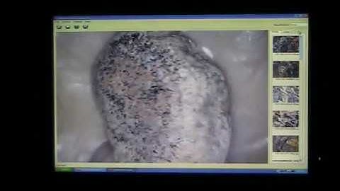 Mudfossil U part 11... Fingers and Toes