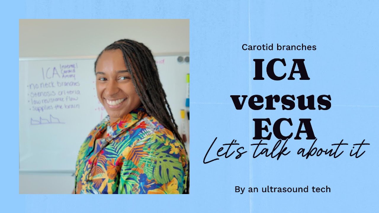 ICA vs ECA | Carotid Branches | Ultrasound Tech #carotid #arteries ...