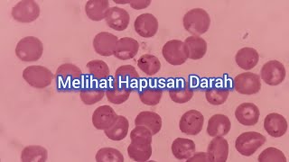 Sel Monosit dan Limfosit dalam Hapusan Darah Tepi | Hitung Jenis Leukosit | Hematologi
