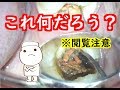 歯の中に色々なものが詰まってます