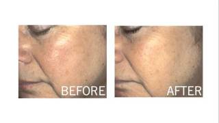 FINAL RF  Soothe 092809 Grey MPEG 4 1