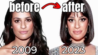 Not "Just" Buccal Fat Removal: Lea Michele's Plastic Surgery Procedures