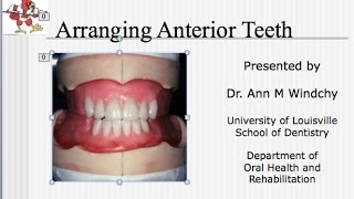 Video #17  C D Arrangement of the Anterior Teeth  Lecture