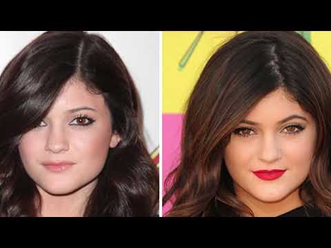 Kylie Jenner ADMITS to PLASTIC SURGERY