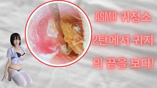 ASMR 귀청소｜2탄에서 귀지의 끝을 보다!
