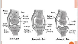 Introduction to Rheumatology screenshot 5