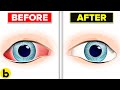 Improve Your Eyesight By Doing Eye Yoga | Exercises For Eyes