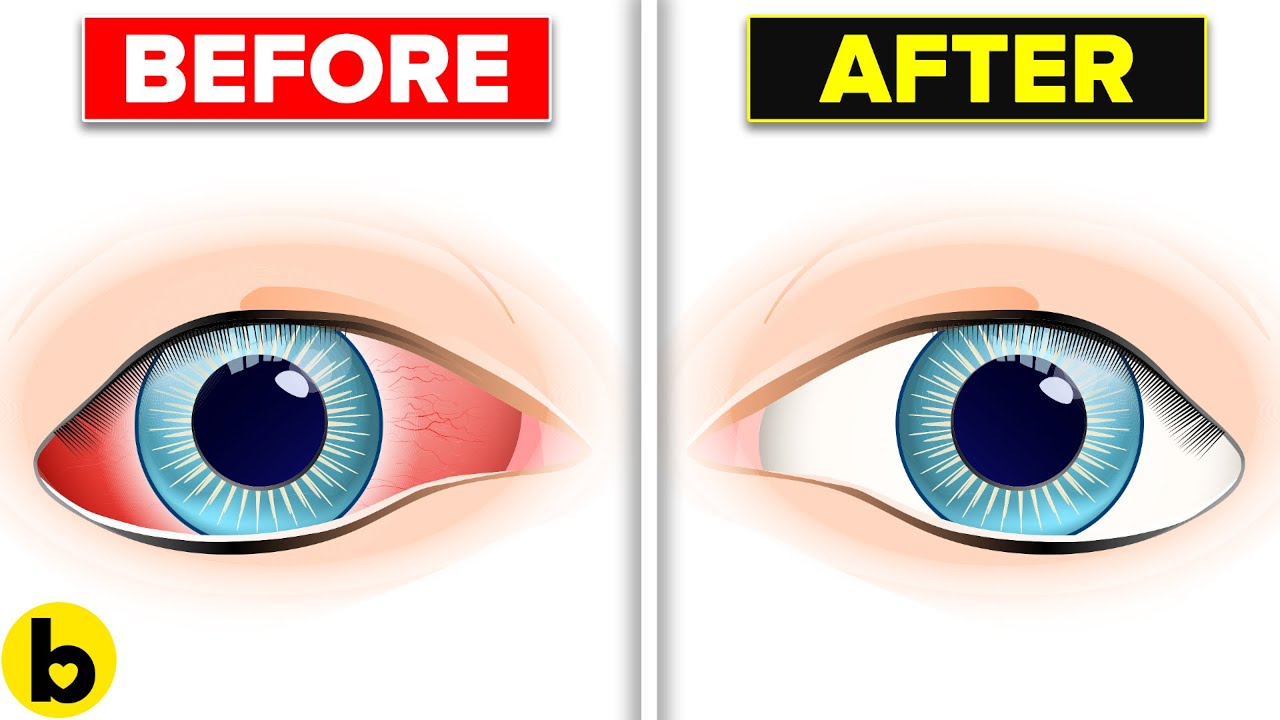 Improve Your Eyesight By Doing Eye Yoga | Exercises For Eyes - YouTube
