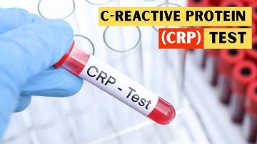 C-Reactive Protein (CRP) Test - Everything You Need To Know