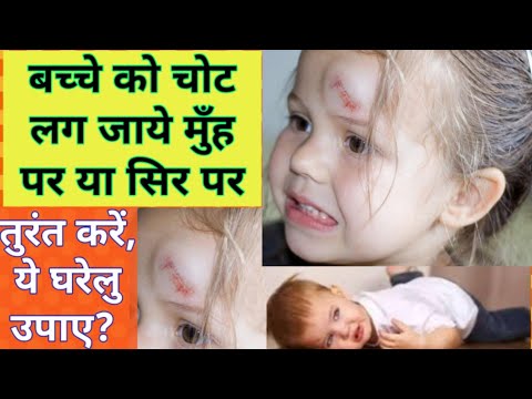 वीडियो: मुझे बच्चे को चोट लगने का डर है क्या करूँ?