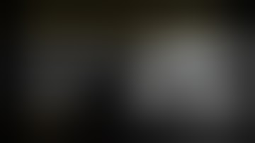 Femoral Revision Through the Anterior Approach