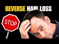 How To Prevent Hair Loss The Easy Way