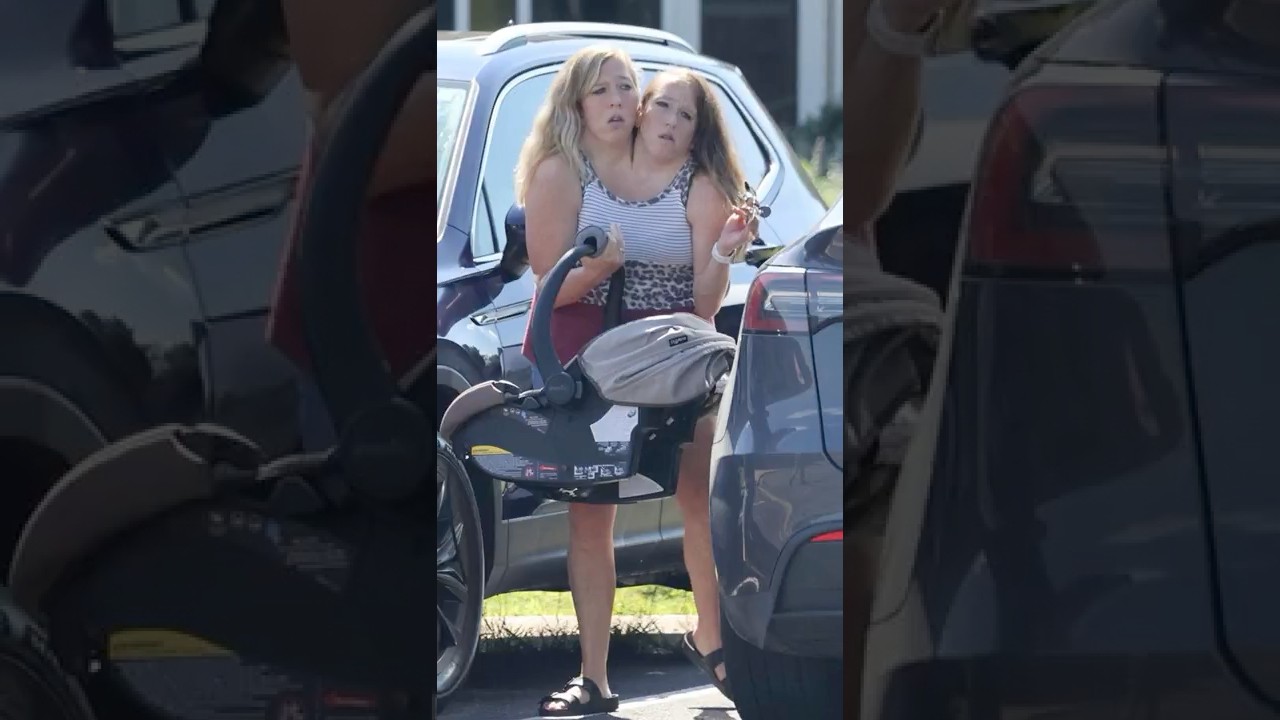 Conjoined Twins Abby and Brittany Hensel Had A Baby