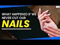 Nail Growth and Hygiene Quiz