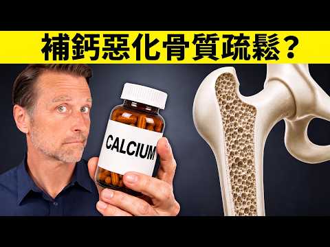 補鈣會加重骨質疏鬆嗎？柏格醫生（Dr. Berg）揭秘骨骼保健真相與7大骨鬆自然療法