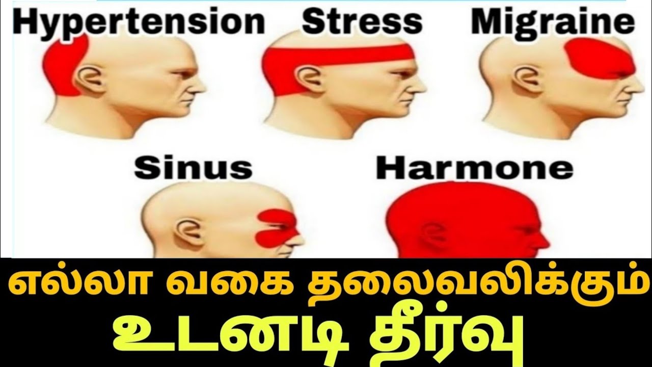 Headache Treatment Tamil Thalaivali Udane Neenga Home Remedies Youtube