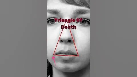 why you Should Never pop A pimple in this area