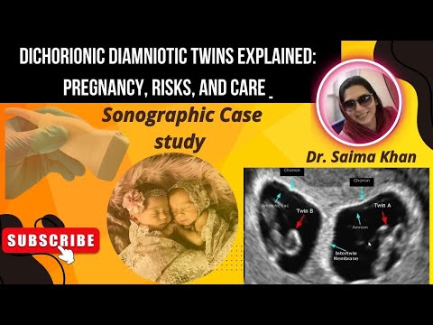 Dichorionic Diamniotic Twins Explained: Pregnancy, Risks, and Care @Dr.Saimakhan