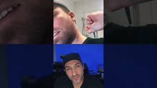 Longest ingrown hair ever????