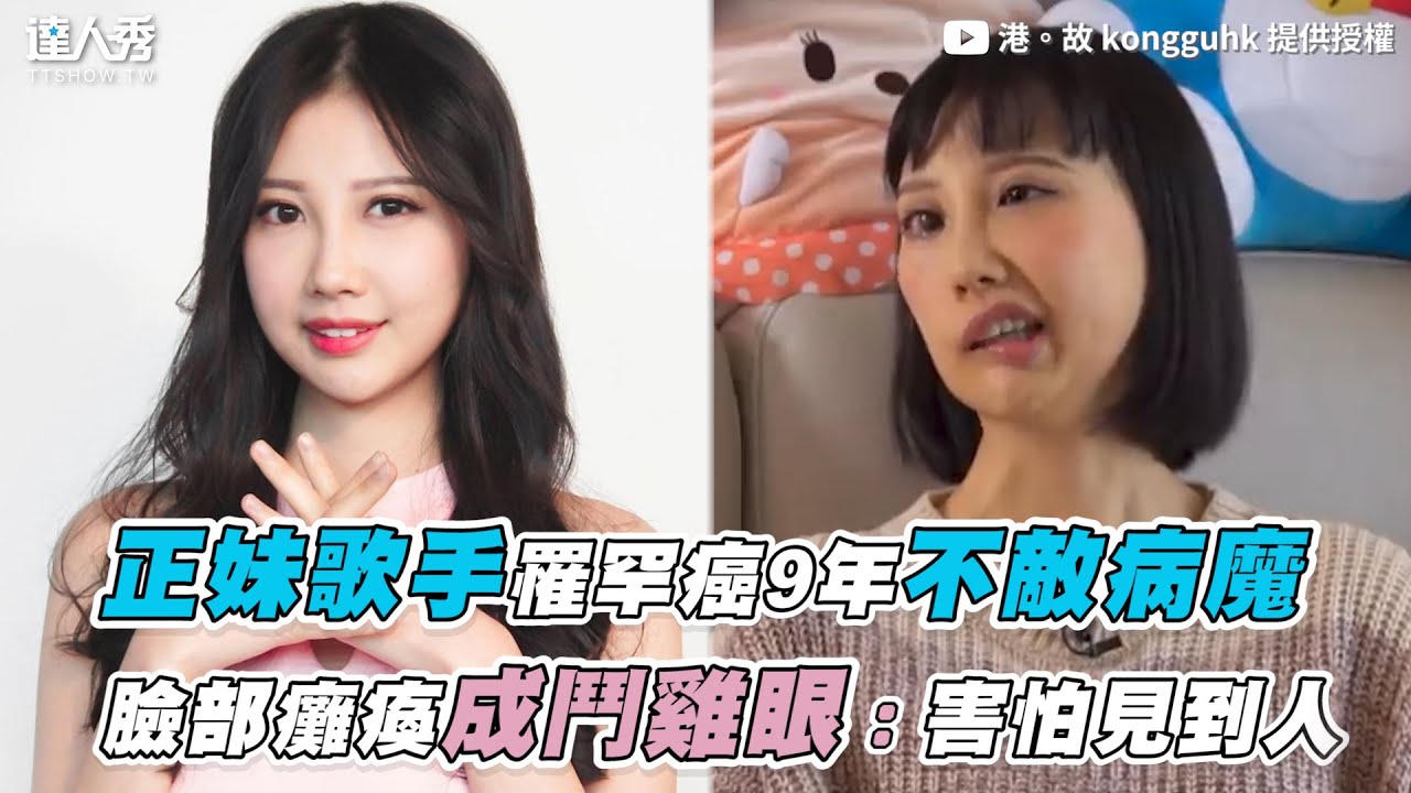 【正妹歌手罹罕癌9年不敵病魔 臉部癱瘓成鬥雞眼：害怕見到人】｜