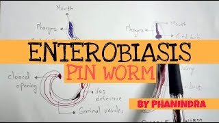 pinworm fejlesztési ciklus diagram)