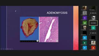4 19 GenPath FGT and Breast Lab Slides Review