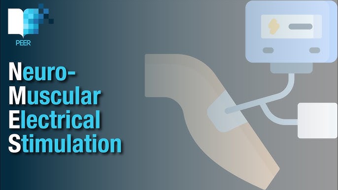 Neuromuscular Electrical Stimulation (NMES) — LIVE4 Sports Physical Therapy  & Wellness Advising