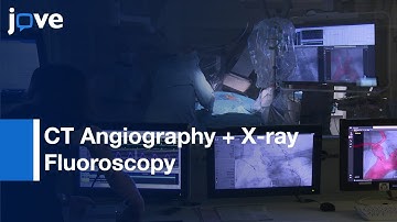 Transcatheter Aortic Valve Implantation: 3D CT Angiography With X-Ray