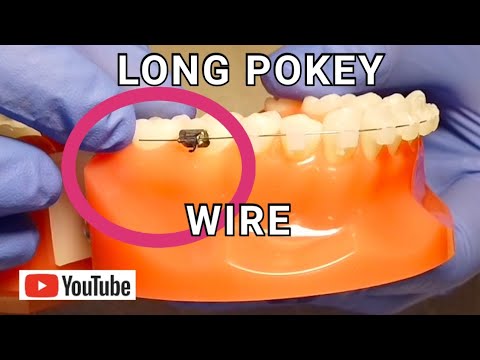 What to do when I have an orthodontic wire sticking out and poking the gums?