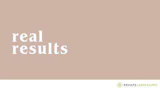 Real Results - Laser Hair Removal for Men