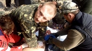 Видео Работа фронтовых реаниматологов. Слабонервным не смотреть (автор: Повернись живим)