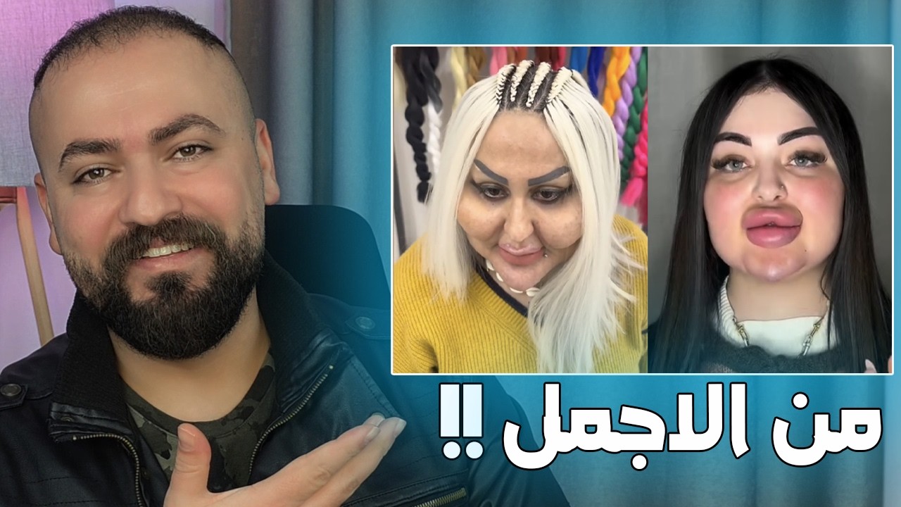 من الاجمل !! وما هي حلول السوشل ميديا ؟؟