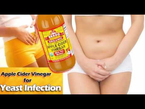 yeast-infection-treatment-by-using-apple-cider-vinegar-|-best-yeast-infection-cure