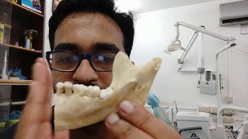 How to anaesthesize a hot tooth?