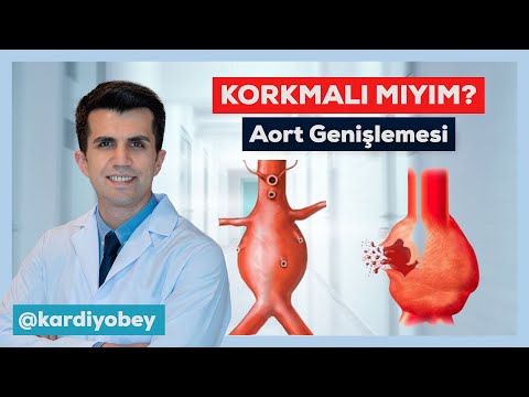 Aort Genişlemesi ve Aort Anevrizması: Riskleri ve Tedavileri