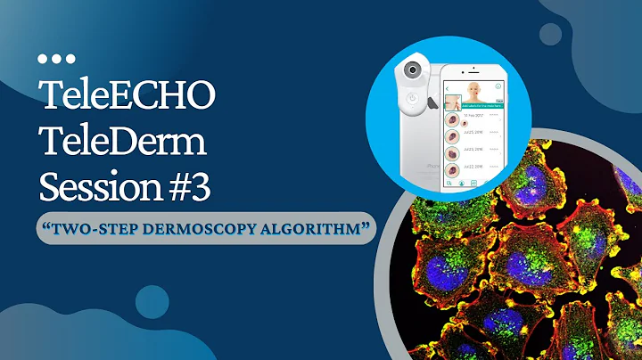 TeleECHO TeleDerm Session #3 - "Two Step Dermoscopy Algorithm"