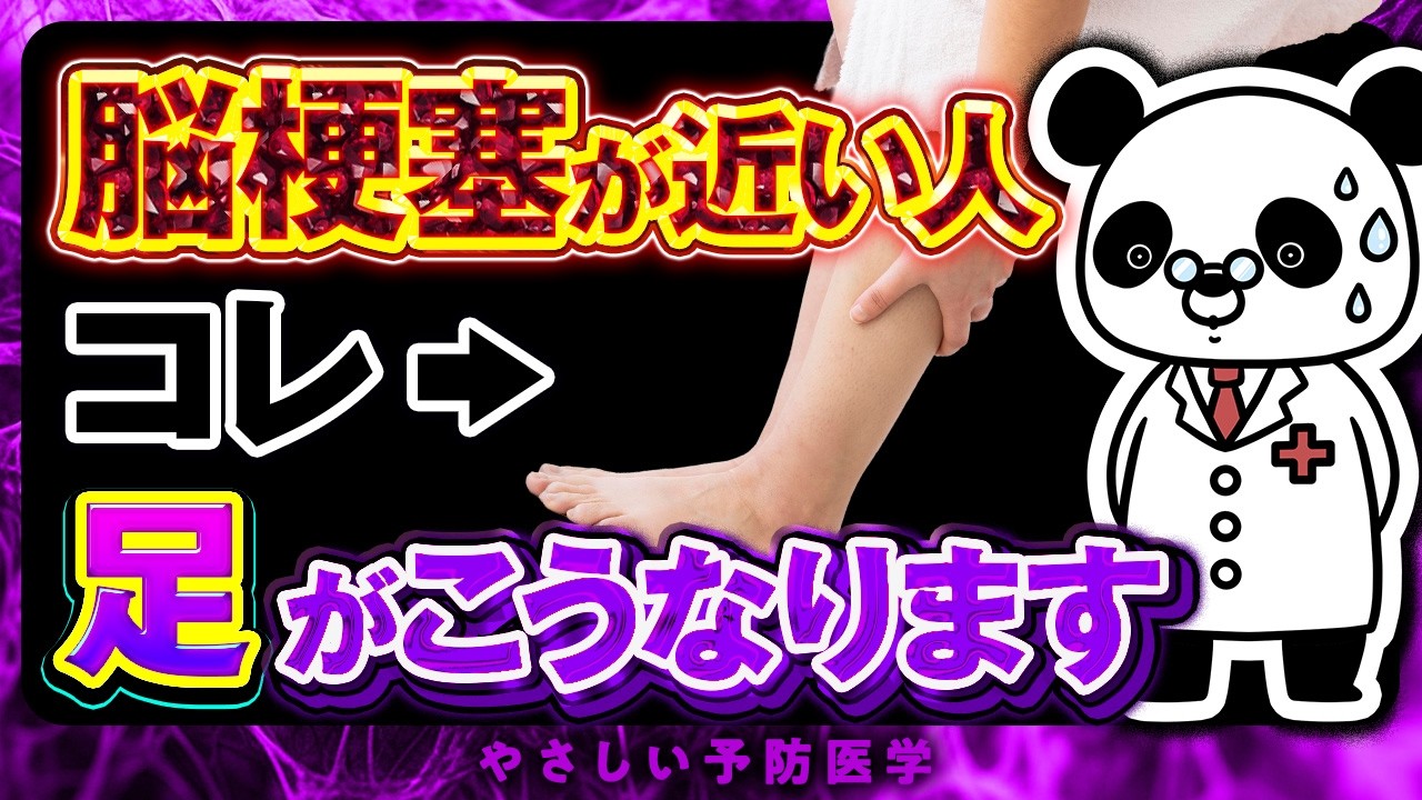 【要注意】絶対知っておいてほしい！脳梗塞が近い人だけに起こる「足の異変」について解説（脳梗塞　危険なサイン）