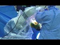 0919 PB Ortho Robotic Total Knee Replacement S1